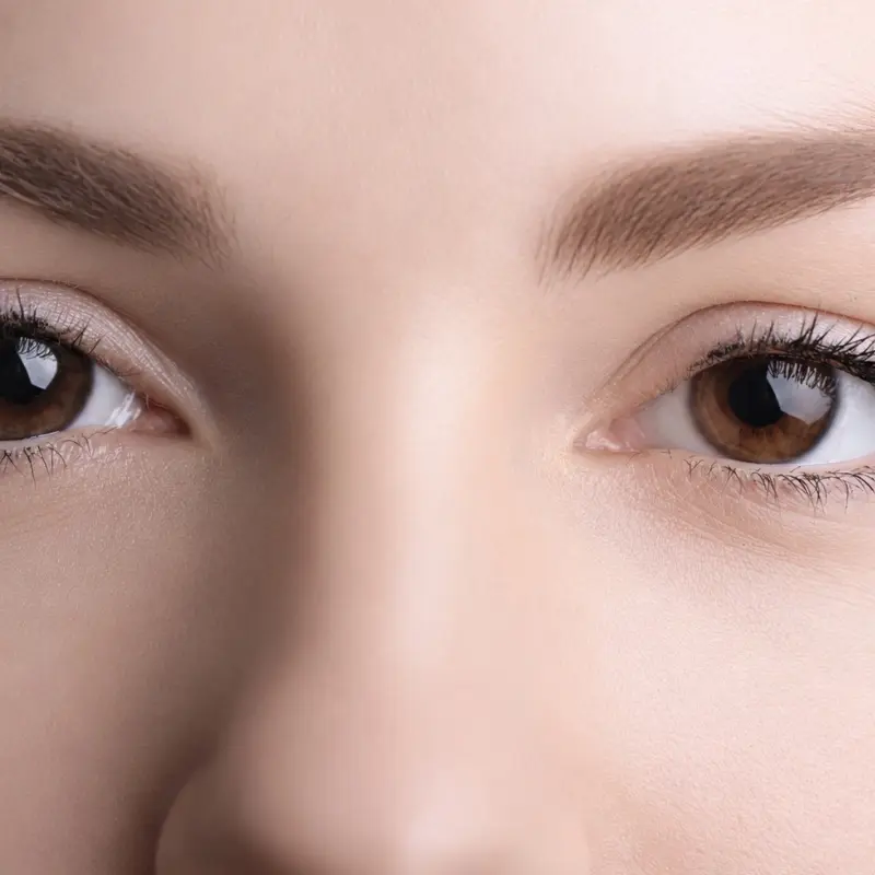 Pigmentation after treatment